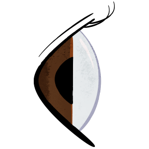 Non-Keratoconus Normal Eye side view